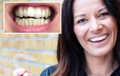 Dr Smile: Révolutionner l’orthodontie grâce à la technologie numérique